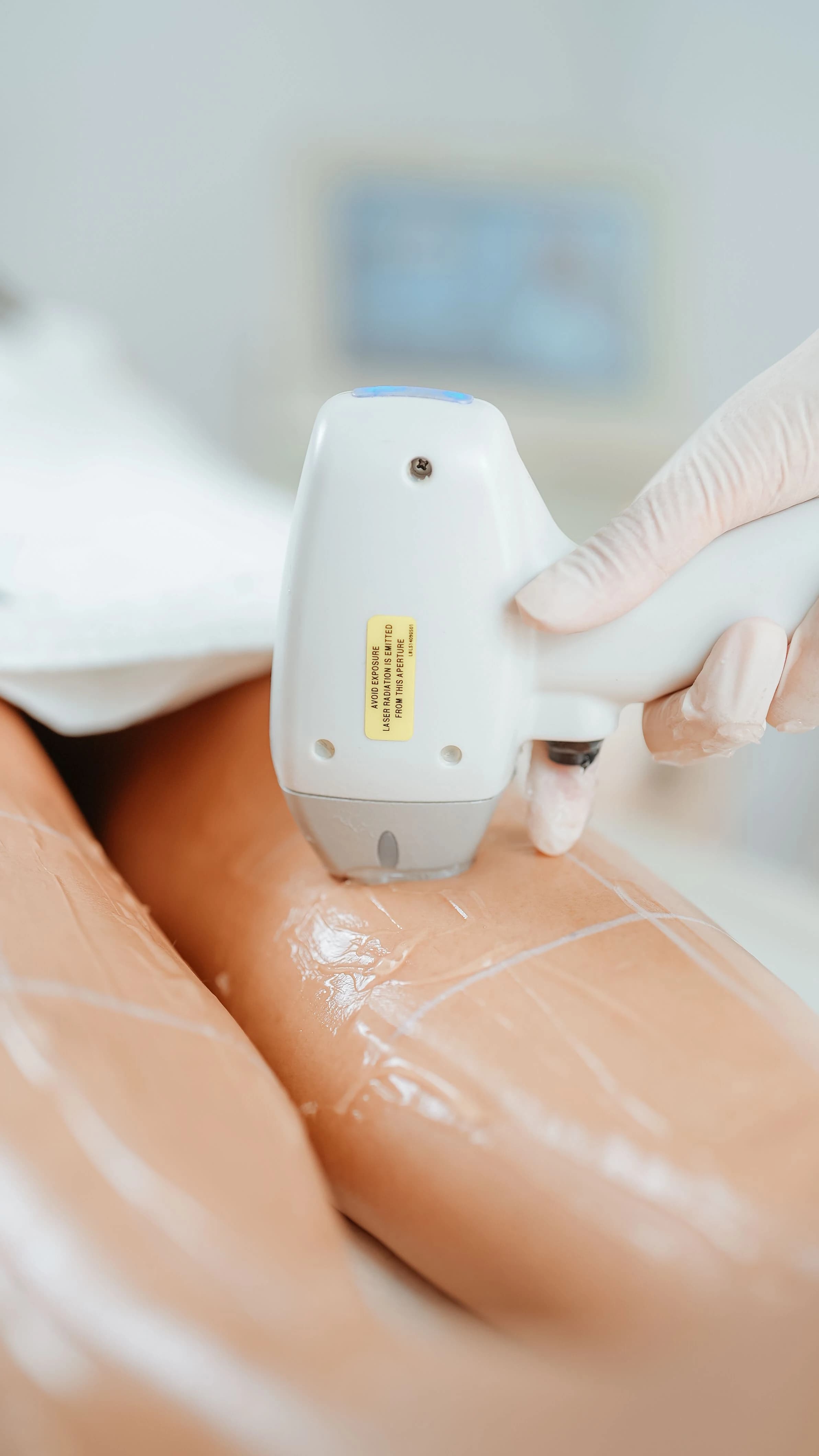 Laser hair removal treatment being performed on a client's leg